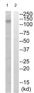 Western blot - Anti-CSF-1-R (phospho Y561) antibody (AB192810)