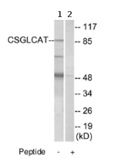 Western blot - Anti-CSGLCAT antibody (AB75050), expandable thumbnail