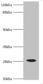 Western blot - Anti-CSHL1/CSL antibody (AB234987)
