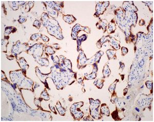 Immunohistochemistry (Formalin/PFA-fixed paraffin-embedded sections) - Anti-CSHL1/CSL antibody [EPR12580] (AB174295)