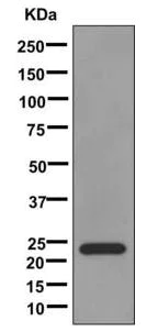 Western blot - Anti-CSHL1/CSL antibody [EPR12580] (AB174295)