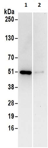 Immunoprecipitation - Anti-CSK antibody (AB186050), expandable thumbnail