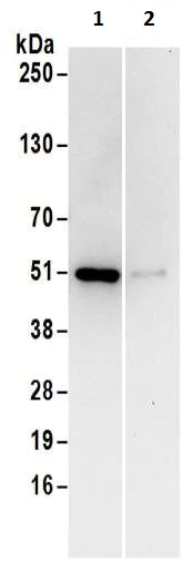 Immunoprecipitation - Anti-CSK antibody (AB186050)