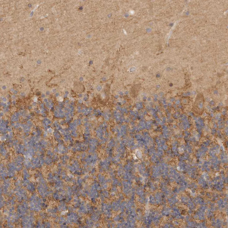 Immunohistochemistry (Formalin/PFA-fixed paraffin-embedded sections) - Anti-CSK antibody (AB244414)