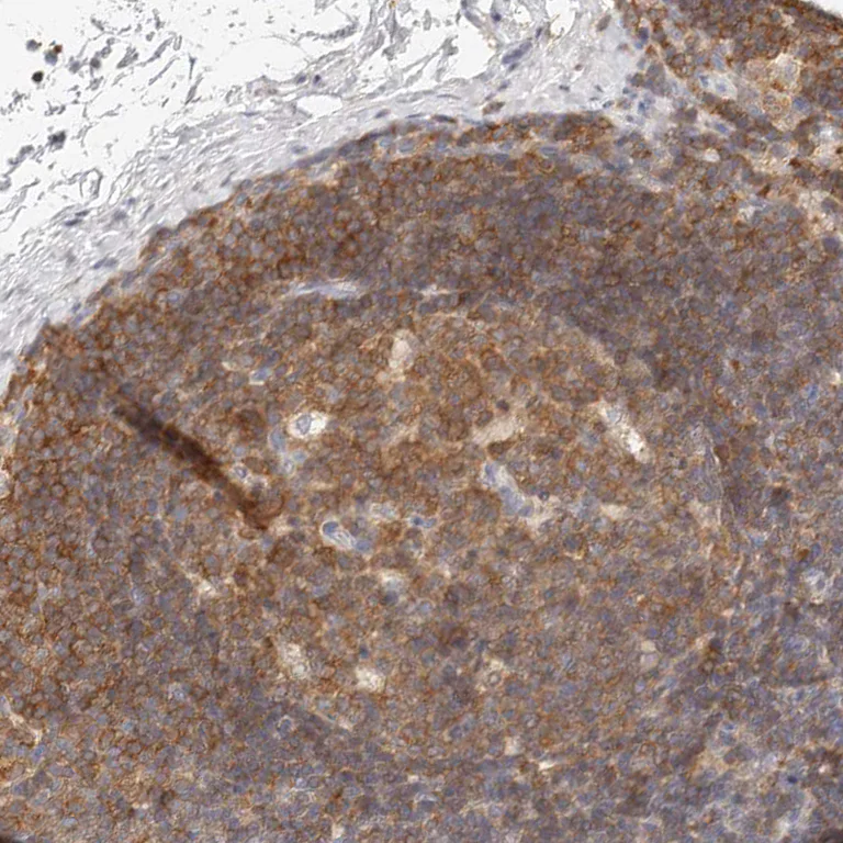 Immunohistochemistry (Formalin/PFA-fixed paraffin-embedded sections) - Anti-CSK antibody (AB244414)
