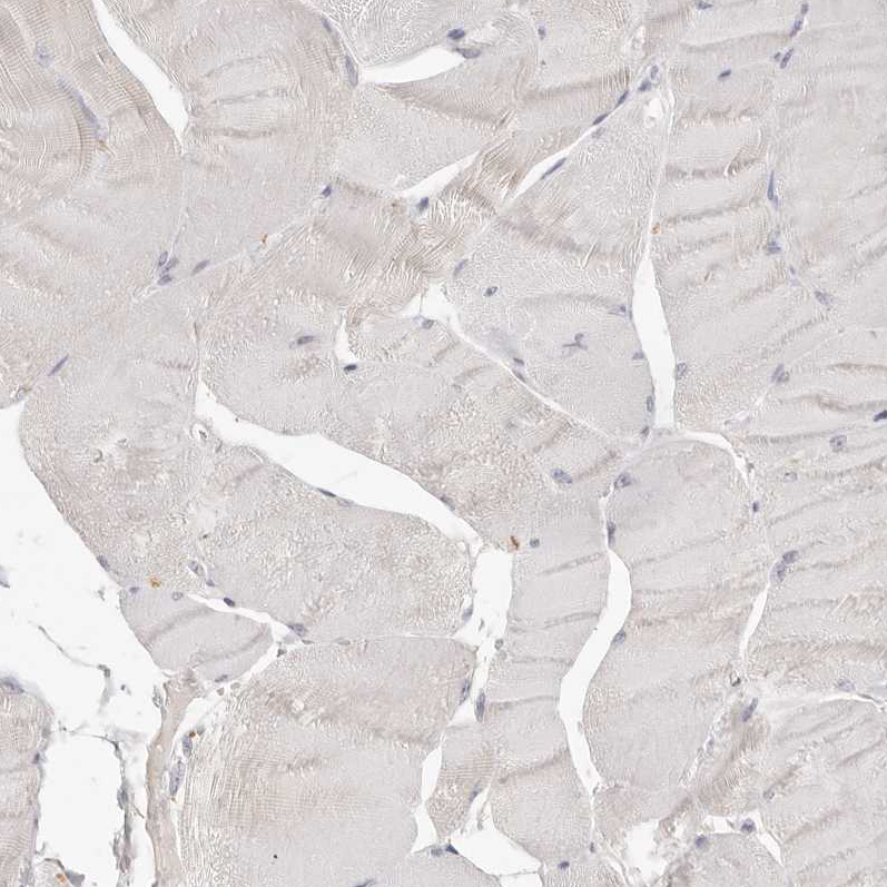 Immunohistochemistry (Formalin/PFA-fixed paraffin-embedded sections) - Anti-CSK antibody (AB244414)