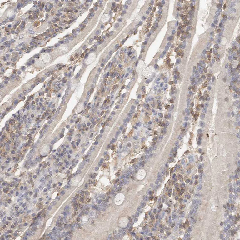 Immunohistochemistry (Formalin/PFA-fixed paraffin-embedded sections) - Anti-CSK antibody (AB244414)