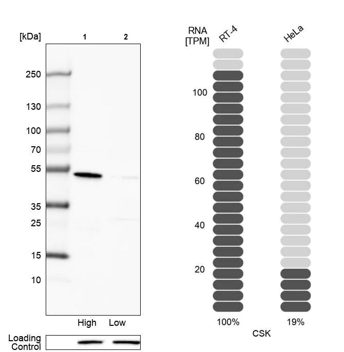 Western blot - Anti-CSK antibody (AB244414)