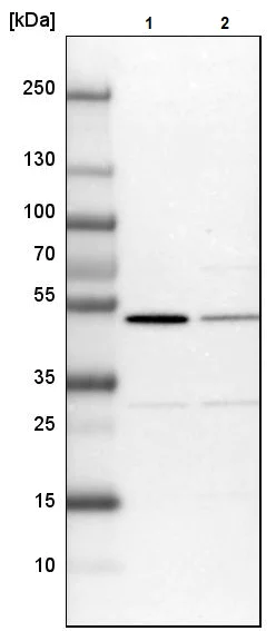 Western blot - Anti-CSK antibody (AB244414)