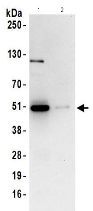 Immunoprecipitation - Anti-CSK antibody - C-terminal (AB186069)