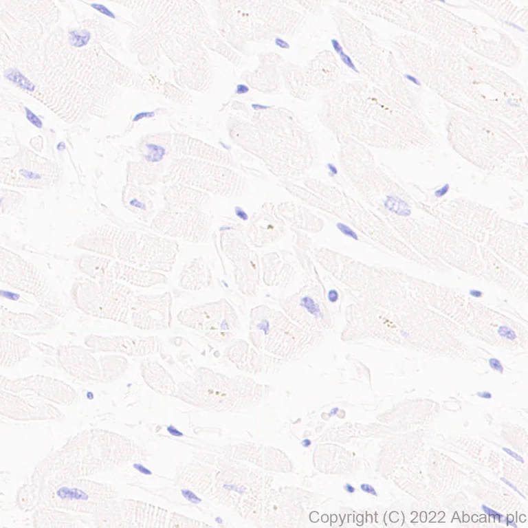 Immunohistochemistry (Formalin/PFA-fixed paraffin-embedded sections) - Anti-CSK antibody [EPR24673-97] (BSA and Azide free) (AB300133)