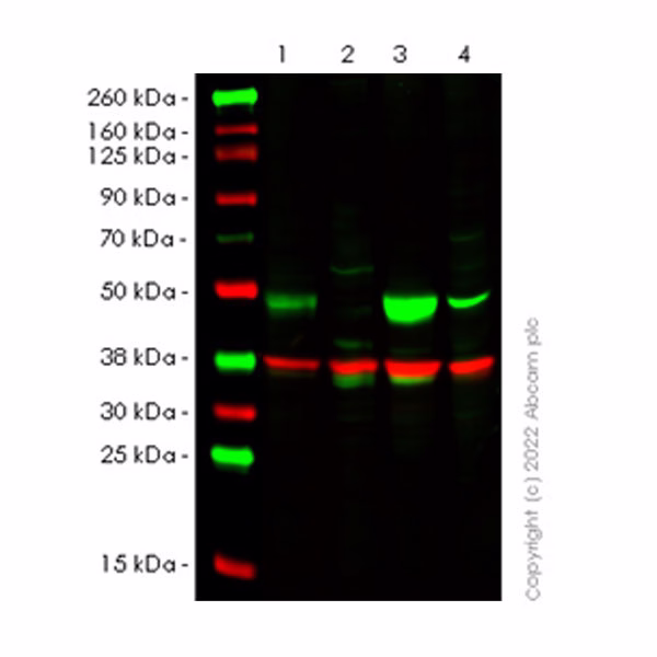 Western blot - Anti-CSK antibody [EPR24673-97] (BSA and Azide free) (AB300133), expandable thumbnail