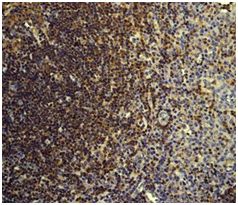 Immunohistochemistry (Formalin/PFA-fixed paraffin-embedded sections) - Anti-CSK antibody [EPR6771] (AB125005)