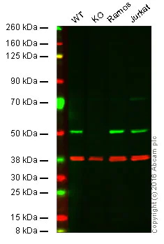 Western blot - Anti-CSK antibody [EPR6771] (AB125005)