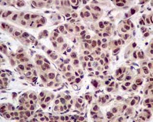 Immunohistochemistry (Formalin/PFA-fixed paraffin-embedded sections) - Anti-CSL4 antibody [EPR13525] (AB181167)