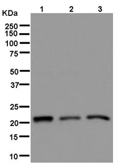 Western blot - Anti-CSL4 antibody [EPR13525] (AB181167)