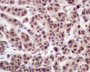 Immunohistochemistry (Formalin/PFA-fixed paraffin-embedded sections) - Anti-CSL4 antibody [EPR13525] - BSA and Azide free (AB250393)