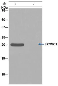 Immunoprecipitation - Anti-CSL4 antibody [EPR13525] - BSA and Azide free (AB250393)