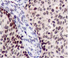 Immunohistochemistry (Formalin/PFA-fixed paraffin-embedded sections) - Anti-CSL4 antibody [EPR13526] (AB181108), expandable thumbnail
