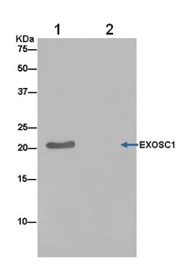 Immunoprecipitation - Anti-CSL4 antibody [EPR13526] (AB181108), expandable thumbnail
