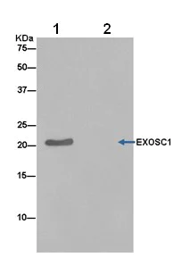 Immunoprecipitation - Anti-CSL4 antibody [EPR13526] (AB181108)