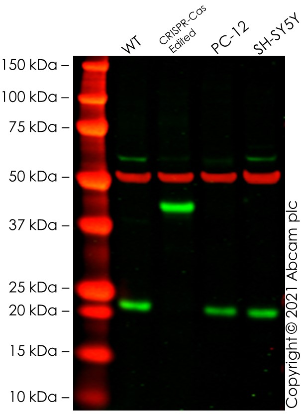 Western blot - Anti-CSL4 antibody [EPR13526] (AB181108), expandable thumbnail