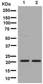 Western blot - Anti-CSL4 antibody [EPR13526] (ab181108), expandable thumbnail