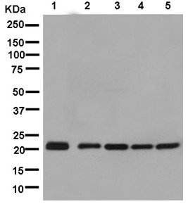 Western blot - Anti-CSL4 antibody [EPR13526] (AB181108), expandable thumbnail