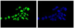Immunocytochemistry/ Immunofluorescence - Anti-CSL4 antibody [EPR13526] - BSA and Azide free (AB250355)