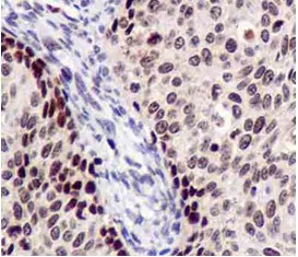 Immunohistochemistry (Formalin/PFA-fixed paraffin-embedded sections) - Anti-CSL4 antibody [EPR13526] - BSA and Azide free (AB250355)