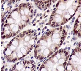 Immunohistochemistry (Formalin/PFA-fixed paraffin-embedded sections) - Anti-CSL4 antibody [EPR13526] - BSA and Azide free (AB250355)