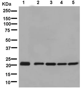Western blot - Anti-CSL4 antibody [EPR13526] - BSA and Azide free (AB250355)