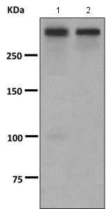 Western blot - Anti-CSMD1 antibody [EPR8656(2)] (AB166908)