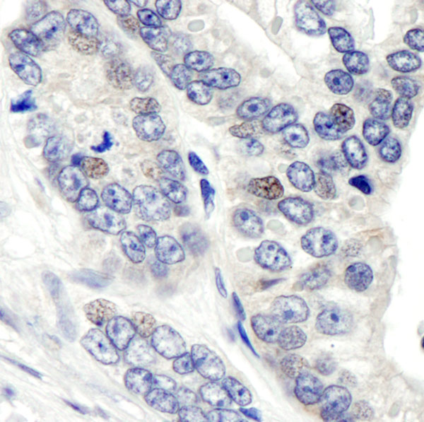 Immunohistochemistry (Formalin/PFA-fixed paraffin-embedded sections) - Anti-CSN1 antibody (AB10413)