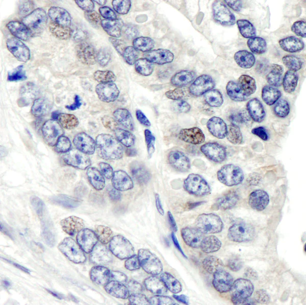 Immunohistochemistry (Formalin/PFA-fixed paraffin-embedded sections) - Anti-CSN1 antibody (AB10413)
