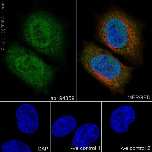 Immunocytochemistry/ Immunofluorescence - Anti-CSN1 antibody [EP15642-22] (AB194359)