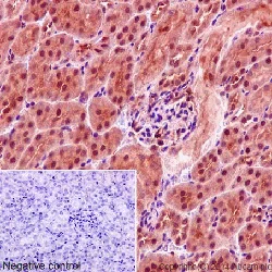 Immunohistochemistry (Formalin/PFA-fixed paraffin-embedded sections) - Anti-CSN1 antibody [EP15642-22] (AB194359)