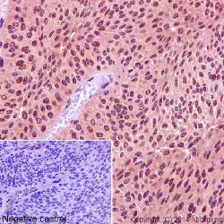 Immunohistochemistry (Formalin/PFA-fixed paraffin-embedded sections) - Anti-CSN1 antibody [EP15642-22] (AB194359)