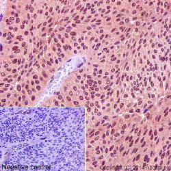 Immunohistochemistry (Formalin/PFA-fixed paraffin-embedded sections) - Anti-CSN1 antibody [EP15642-22] - BSA and Azide free (AB284850)