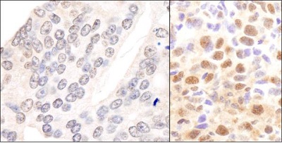 Immunohistochemistry (Formalin/PFA-fixed paraffin-embedded sections) - Anti-CSN2 antibody (AB10426)