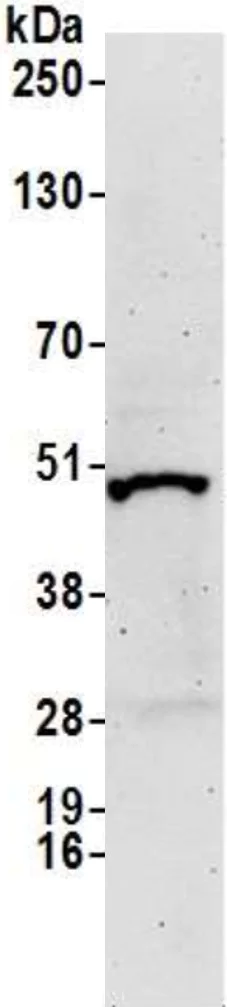 Western blot - Anti-CSN2 antibody (AB10426)