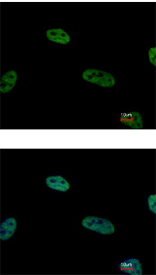 Immunocytochemistry/ Immunofluorescence - Anti-CSN2 antibody (AB155774), expandable thumbnail