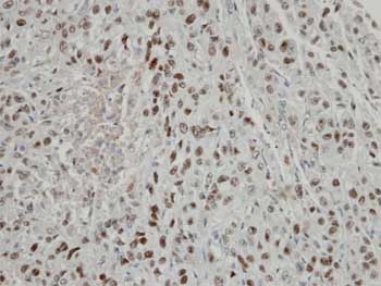 Immunohistochemistry (Formalin/PFA-fixed paraffin-embedded sections) - Anti-CSN2 antibody (AB155774), expandable thumbnail