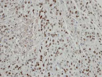 Immunohistochemistry (Formalin/PFA-fixed paraffin-embedded sections) - Anti-CSN2 antibody (AB155774)