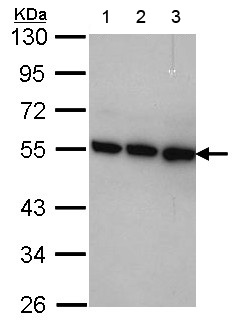 Western blot - Anti-CSN2 antibody (AB155774), expandable thumbnail