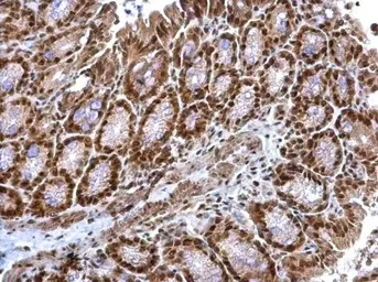 Immunohistochemistry (Formalin/PFA-fixed paraffin-embedded sections) - Anti-CSN2 antibody (AB155920)