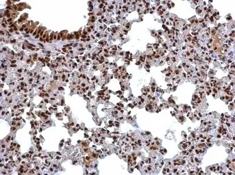 Immunohistochemistry (Formalin/PFA-fixed paraffin-embedded sections) - Anti-CSN2 antibody (AB155920)