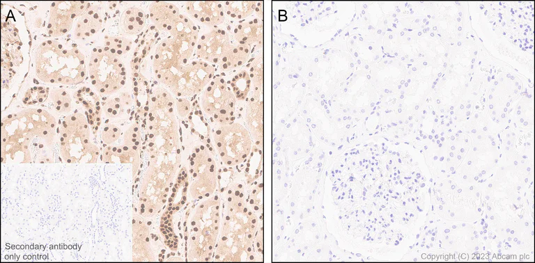 Immunohistochemistry (Formalin/PFA-fixed paraffin-embedded sections) - Anti-CSN2 (phospho S24) antibody [EPR25868-2] (AB313769)