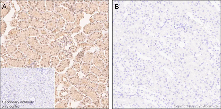 Immunohistochemistry (Formalin/PFA-fixed paraffin-embedded sections) - Anti-CSN2 (phospho S24) antibody [EPR25868-2] (AB313769)