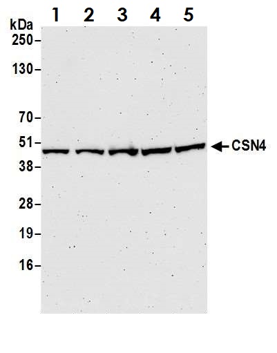 Western blot - Anti-CSN4 antibody (AB12322), expandable thumbnail